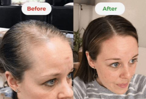 Scalpistry Before And After