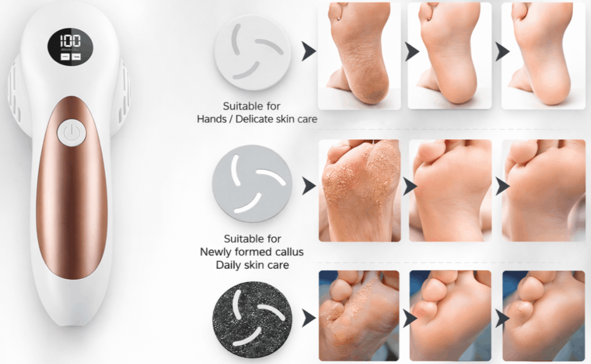 Solasilk Electric Callus Remover Features