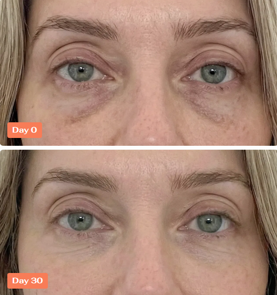 Koreana Skin Peptide Repair Eye Mask Benefits