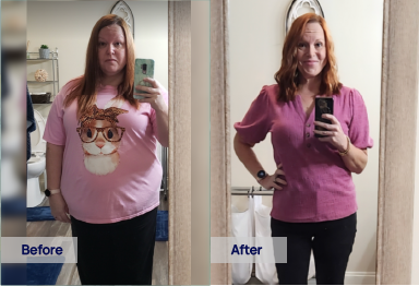 Sunlight GLP-1 Weight Loss