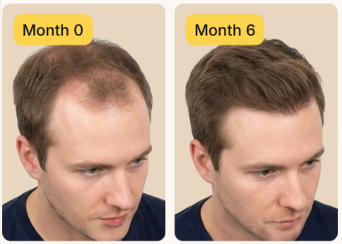 Keeps Hair Loss benefis