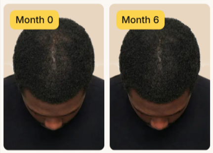 Keeps Topical Drop benefits