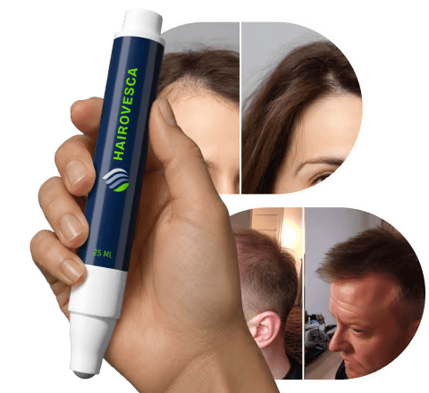 Hairovesca benefits