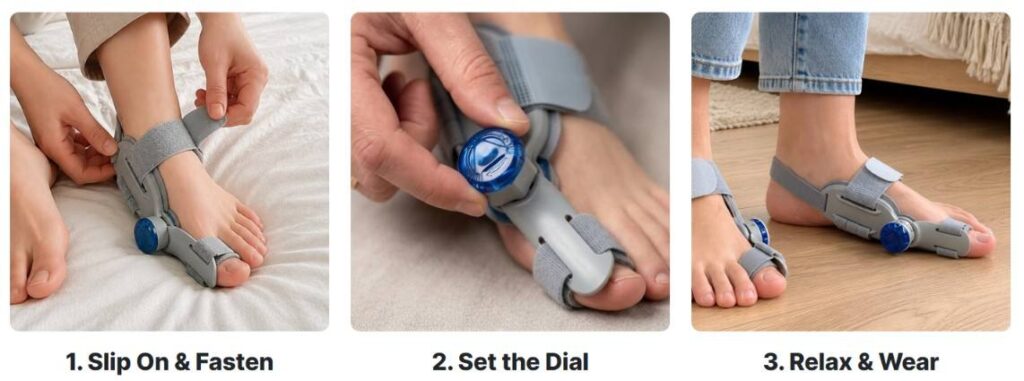 Hallux Bunion Corrector Use