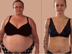 Lipo Jelly Customer 1