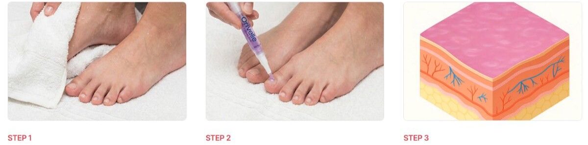 Orivell Fungus Pen uses