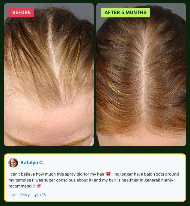 HaloGrow Hair Spray uses 90 days experience