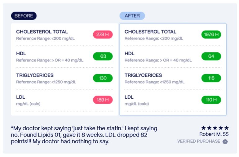Lipids 01 before and after