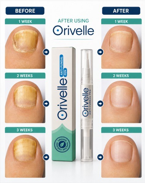 Orivelle Fungus Pen Before and After