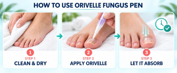 Orivelle Fungus Pen uses