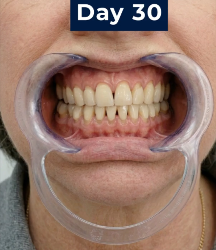 Toothcare timeline