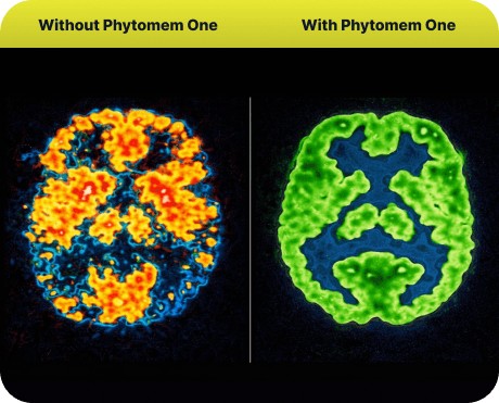 Phytomem One before after