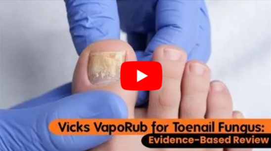 vick vaporub fungus